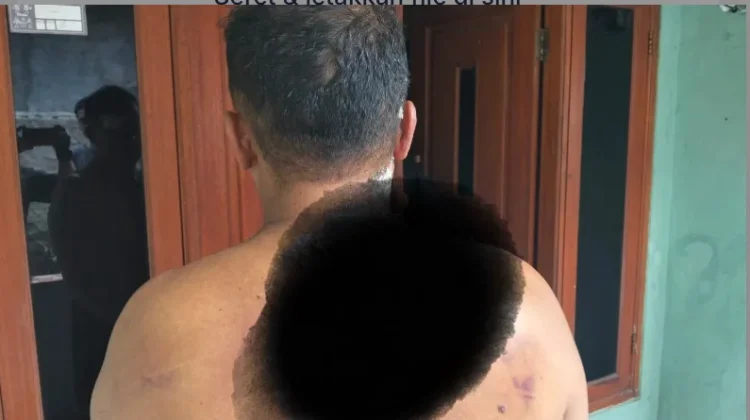 Dituduh Curi Helm, Pekerja di Cileungsi Bogor Dikeroyok Warga