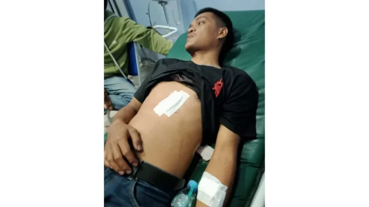Pengawas SPBU di Bogor Ditusuk saat Pergoki Modus Ganjal ATM