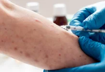 Pemerintah Jamin Ketersediaan Vaksin MR untuk Percepat Pengendalian Campak