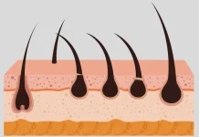 Bahaya Rambut Tumbuh di Bawah Kulit, Ketahui Cara Menanganinya