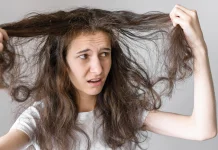 Kondisi Rambut Bermasalah, Bisa Jadi Alarm Kekurangan Gizi