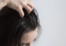 Rambut Cepat Lepek? Kenali Penyebab dan Cara Mengatasinya