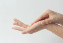 Ketahui Cara Merawat Kulit Tangan Kering agar Tetap Terhidrasi