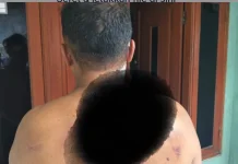 Dituduh Curi Helm, Pekerja di Cileungsi Bogor Dikeroyok Warga
