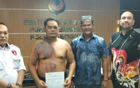 Polres Bogor Tangani Kasus Korban Main Hakim Sendiri di Cileungsi