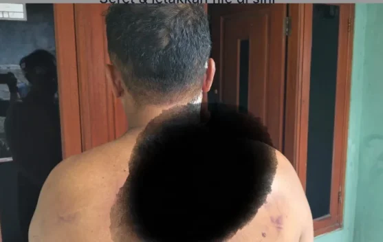 Dituduh Curi Helm, Pekerja di Cileungsi Bogor Dikeroyok Warga
