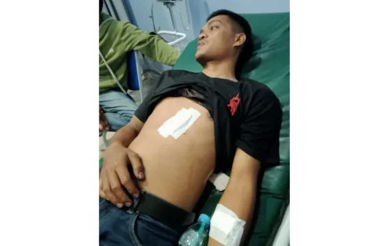 Pengawas SPBU di Bogor Ditusuk saat Pergoki Modus Ganjal ATM