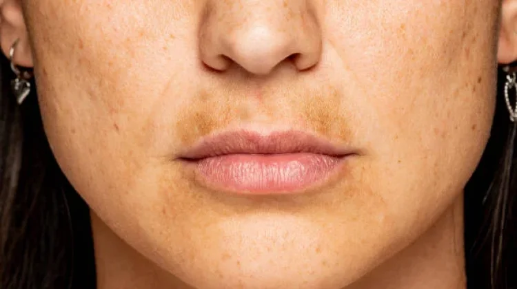 Tips Mencerahkan Bibir Secara Alami