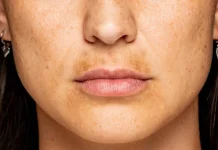 Tips Mencerahkan Bibir Secara Alami