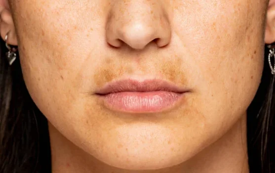 Tips Mencerahkan Bibir Secara Alami