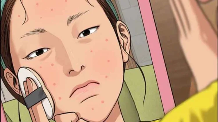 Kulit Berjerawat? Begini Cara Pilih Skincare Tepat