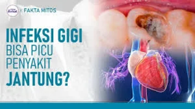 Sakit Gigi bisa Menyebabkan Jantung Bocor?