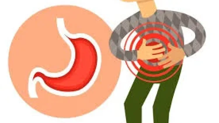 Perbedaan GERD, Maag, dan Asam Lambung Biasa yang Sering Disalahpahami