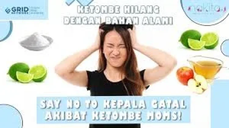 Cara Alami Mengatasi Masalah Ketombe