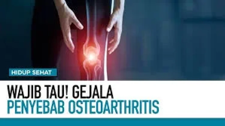 Kenali Gejala Osteoarthritis