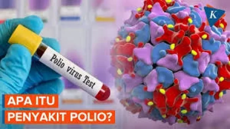 Penyebab, dan Proses Pemulihan Polio