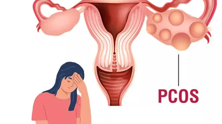 Penyakit Kewanitaan Berbahaya yang Wajib Diwaspadai sejak Dini