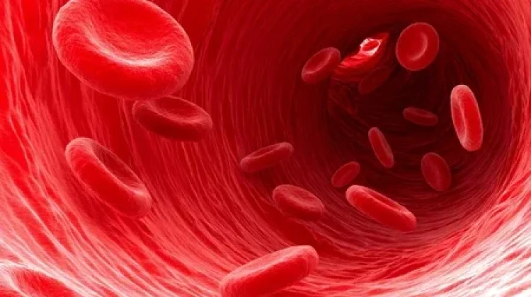 Anemia: Jangan Anggap Remeh Kekurangan Sel Darah Merah