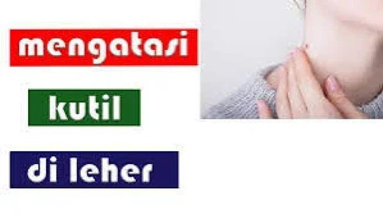 Penyebab Kutil di Leher