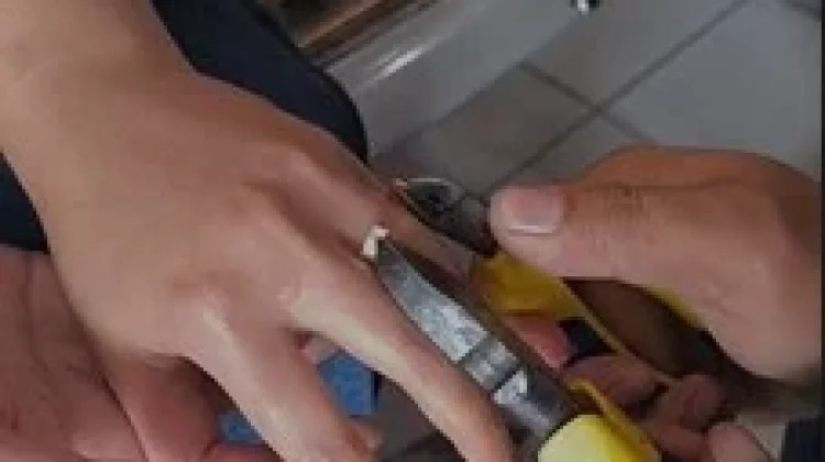 Cincin Bersarang, Damkar Bukittinggi Selamatkan Jari Warga Bengkak