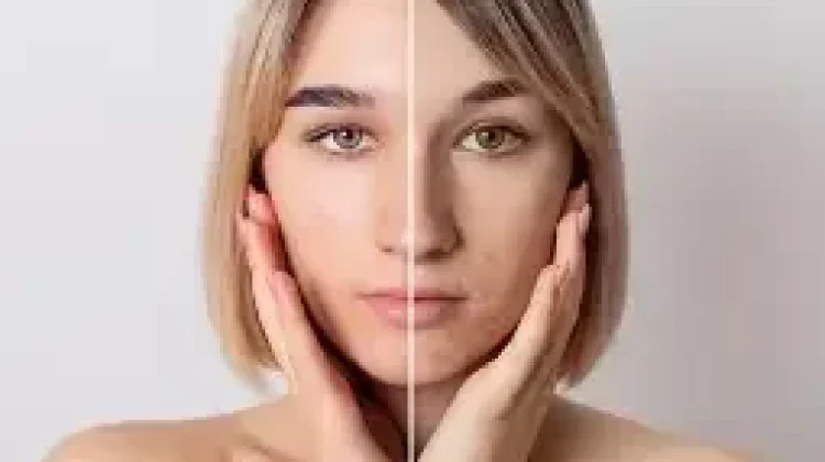 Sering Dilakukan, tapi Salah, "Kebiasaan Skincare yang Bisa Merusak Skin Barrier"