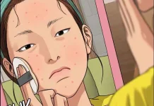 Kulit Berjerawat? Begini Cara Pilih Skincare Tepat