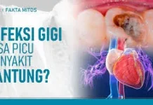 Sakit Gigi bisa Menyebabkan Jantung Bocor?