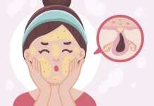 Menjaga Wajah Tetap Segar meski Memiliki Oily skin