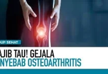 Kenali Gejala Osteoarthritis