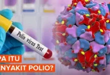 Penyebab, dan Proses Pemulihan Polio