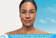 Paparan Sinar Matahari, dan Kulit Hitam