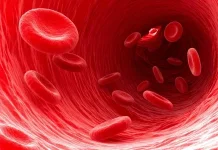 Anemia: Jangan Anggap Remeh Kekurangan Sel Darah Merah