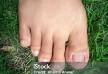 Beragam Penyebab Jempol Kaki Kebas