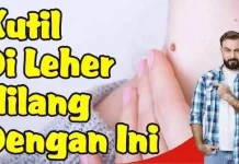 Cara Menangani Kutil pada Kulit