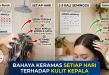 Bahaya Keramas Setiap Hari Terhadap Kulit Kepala