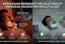 Bahaya Bernapas lewat Mulut Terhadap Gigi