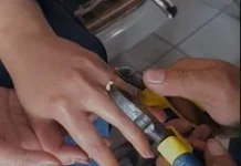 Cincin Bersarang, Damkar Bukittinggi Selamatkan Jari Warga Bengkak