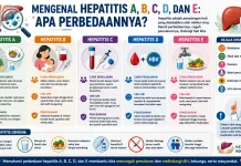 Mengenal Hepatitis A, B, C, D, dan E, Apa Perbedaannya?