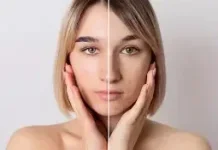 Sering Dilakukan, tapi Salah, "Kebiasaan Skincare yang Bisa Merusak Skin Barrier"