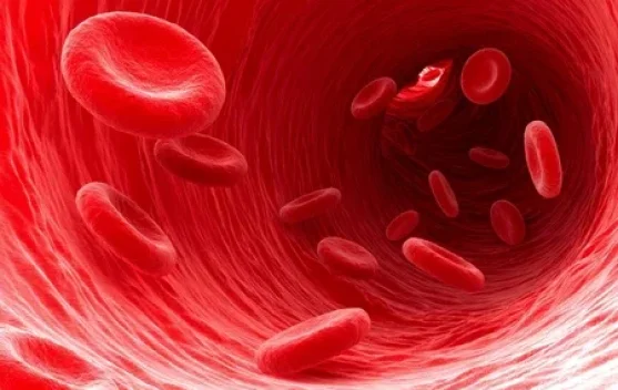 Anemia: Jangan Anggap Remeh Kekurangan Sel Darah Merah
