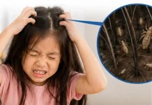 Benarkah Kutu Kecil Lebih Gatal daripada Kutu Besar?