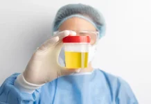 Urine Kuning Pekat Bukan Selalu Tanda Gagal Ginjal