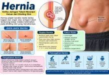 Mengetahui Lebih Banyak Tentang Hernia