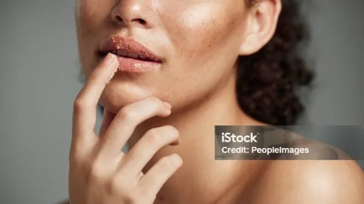 Bibir Sehat dengan Rutin Eksfoliasi