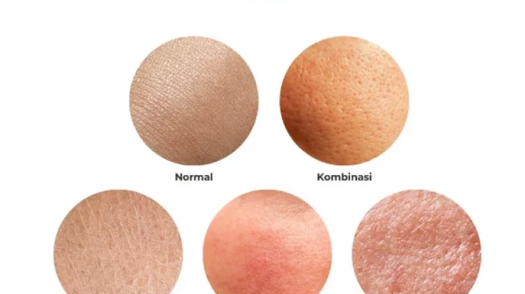 Yuk Cek! Formulasi Skincare yang cocok buat kamu