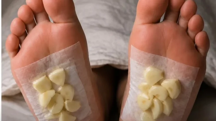 Benarkah Meletakkan Bawang Putih di Telapak Kaki Efektif Detoks Tubuh ?