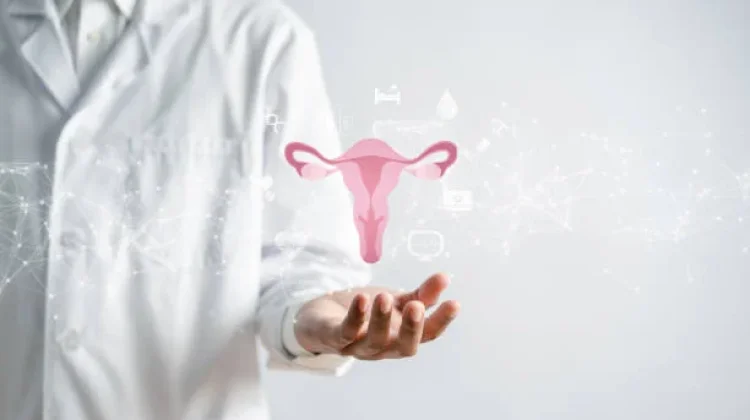Sering Telat Menstruasi? Waspadai Gejala PCOS