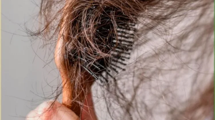 Sepuluh Kebiasaan yang Memperparah Kerontokan Rambut
