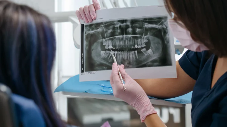 Kenali Jenis, Manfaat, dan Kapan Pemeriksaan Radiografi Gigi Dibutuhkan