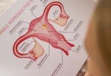 Bukan Lagi PCOS, Kenali Istilah Baru PMOS